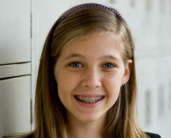 Girl with Braces